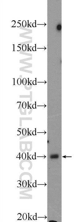 CTBS Rabbit anti-Human, Mouse, Rat, Polyclonal, Proteintech 150 &mu;L;