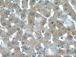 GCLC Rabbit anti-Human, Mouse, Rat, Polyclonal, Proteintech:Antibodies:Primary