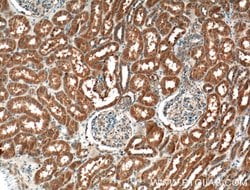 GCLC Rabbit anti-Human, Mouse, Rat, Polyclonal, Proteintech:Antibodies:Primary