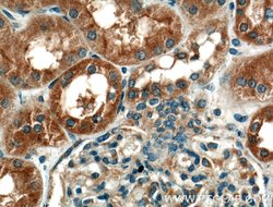 GCLC Rabbit anti-Human, Mouse, Rat, Polyclonal, Proteintech:Antibodies:Primary