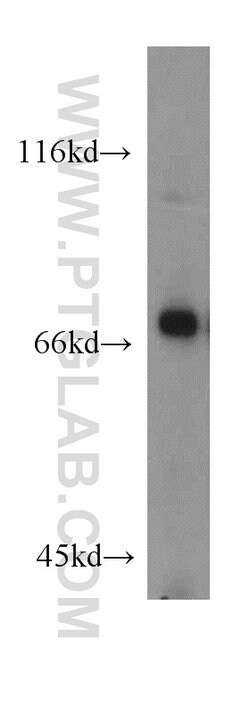 GCLC Rabbit anti-Human, Mouse, Rat, Polyclonal, Proteintech:Antibodies:Primary