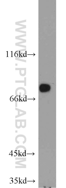 GCLC Rabbit anti-Human, Mouse, Rat, Polyclonal, Proteintech:Antibodies:Primary