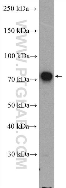 GCLC Rabbit anti-Human, Mouse, Rat, Polyclonal, Proteintech:Antibodies:Primary