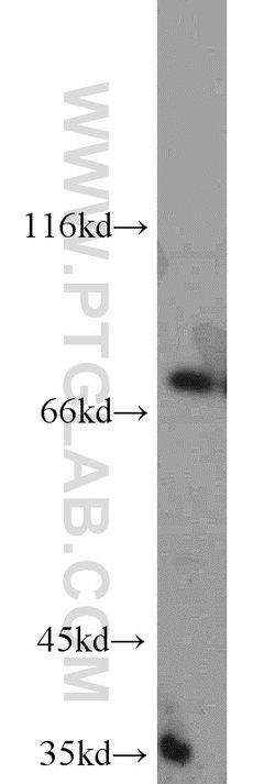 GCLC Rabbit anti-Human, Mouse, Rat, Polyclonal, Proteintech:Antibodies:Primary