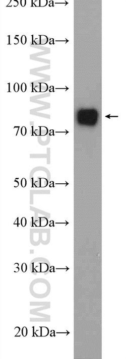 GCLC Rabbit anti-Human, Mouse, Rat, Polyclonal, Proteintech:Antibodies:Primary