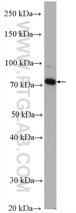 GCLC Rabbit anti-Human, Mouse, Rat, Polyclonal, Proteintech:Antibodies:Primary