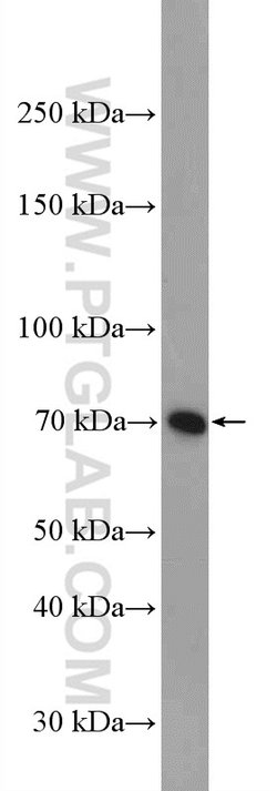 GCLC Rabbit anti-Human, Mouse, Rat, Polyclonal, Proteintech:Antibodies:Primary
