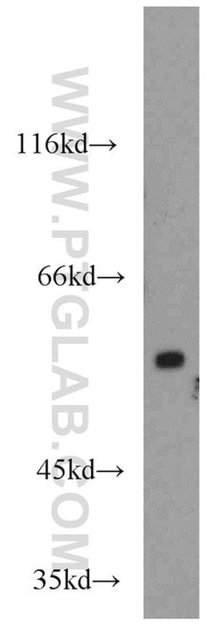 TRIM23 Rabbit anti-Human, Mouse, Polyclonal, Proteintech 150 &mu;L; Unconjugated:Antibodies,