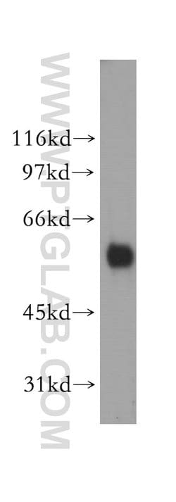 PIGB Rabbit anti-Human, Mouse, Rat, Polyclonal, Proteintech:Antibodies:Primary