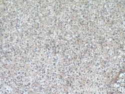 GNAI1 Rabbit anti-Human, Mouse, Rat, Polyclonal, Proteintech 20 &mu;L;