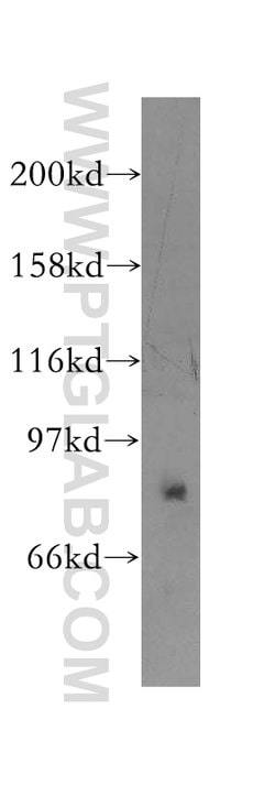 PPP2R1B Rabbit anti-Human, Mouse, Rat, Polyclonal, Proteintech 20 &mu;L;