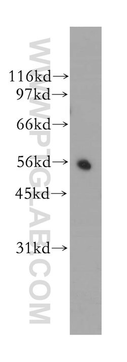 CYB5R4 Rabbit anti-Human, Mouse, Rat, Polyclonal, Proteintech:Antibodies:Primary