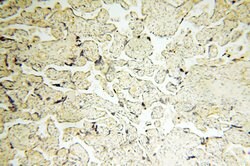 LAMP3 Rabbit anti-Human, Mouse, Rat, Polyclonal, Proteintech:Antibodies:Primary