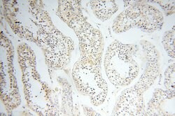 LAMP3 Rabbit anti-Human, Mouse, Rat, Polyclonal, Proteintech:Antibodies:Primary