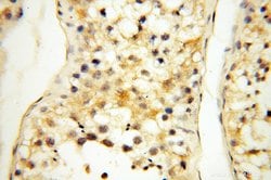LAMP3 Rabbit anti-Human, Mouse, Rat, Polyclonal, Proteintech:Antibodies:Primary