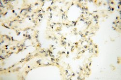 LAMP3 Rabbit anti-Human, Mouse, Rat, Polyclonal, Proteintech:Antibodies:Primary