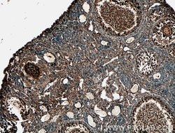 DAZL Rabbit anti-Human, Mouse, Rat, Polyclonal, Proteintech:Antibodies:Primary
