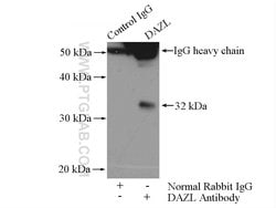 DAZL Rabbit anti-Human, Mouse, Rat, Polyclonal, Proteintech:Antibodies:Primary