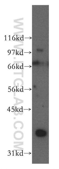 DAZL Rabbit anti-Human, Mouse, Rat, Polyclonal, Proteintech:Antibodies:Primary