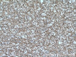 GNAO1 Rabbit anti-Human, Mouse, Rat, Polyclonal, Proteintech:Antibodies:Primary