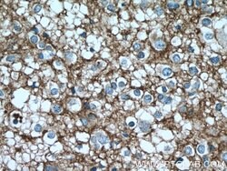 GNAO1 Rabbit anti-Human, Mouse, Rat, Polyclonal, Proteintech:Antibodies:Primary