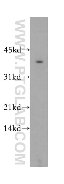 GNAO1 Rabbit anti-Human, Mouse, Rat, Polyclonal, Proteintech:Antibodies:Primary