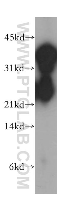 GNAO1 Rabbit anti-Human, Mouse, Rat, Polyclonal, Proteintech:Antibodies:Primary