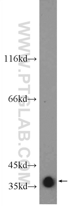 GNAO1 Rabbit anti-Human, Mouse, Rat, Polyclonal, Proteintech:Antibodies:Primary