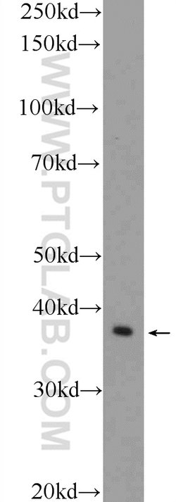 GNAO1 Rabbit anti-Human, Mouse, Rat, Polyclonal, Proteintech:Antibodies:Primary