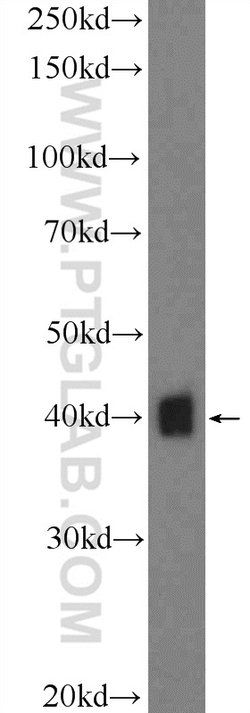 GNAO1 Rabbit anti-Human, Mouse, Rat, Polyclonal, Proteintech:Antibodies:Primary