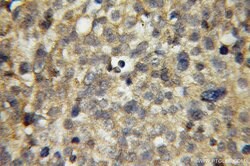 APPL1 Rabbit anti-Human, Mouse, Rat, Polyclonal, Proteintech 150 &mu;L;