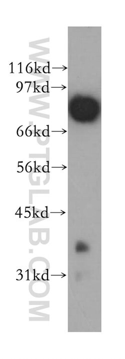 APPL1 Rabbit anti-Human, Mouse, Rat, Polyclonal, Proteintech 150 &mu;L;