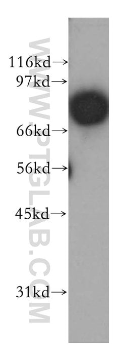 APPL1 Rabbit anti-Human, Mouse, Rat, Polyclonal, Proteintech 150 &mu;L;