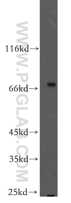 SHC4 Rabbit anti-Human, Mouse, Polyclonal, Proteintech:Antibodies:Primary