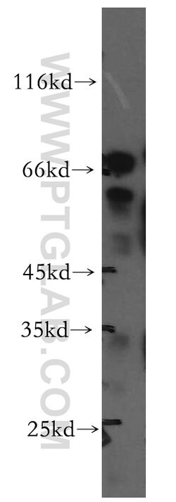 SHC4 Rabbit anti-Human, Mouse, Polyclonal, Proteintech:Antibodies:Primary