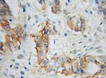 Thumbnail_IL5RA Rabbit anti-Human, Mouse, Rat, Polyclonal, Proteintech:Antibodies:Primary