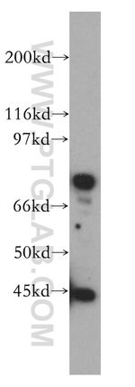 Thumbnail_IL5RA Rabbit anti-Human, Mouse, Rat, Polyclonal, Proteintech:Antibodies:Primary