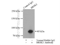 BRSK1 Rabbit anti-Human, Mouse, Rat, Polyclonal, Proteintech 150 &mu;L | Buy Online | Proteintech Group Inc | Fisher Scientific