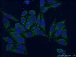 PPP2R5A Rabbit anti-Human, Mouse, Rat, Polyclonal, Proteintech:Antibodies:Primary
