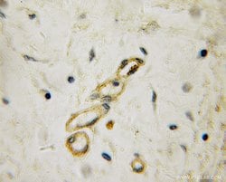 PPP2R5A Rabbit anti-Human, Mouse, Rat, Polyclonal, Proteintech:Antibodies:Primary