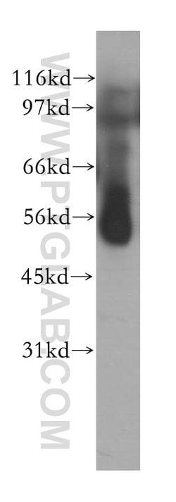 PPP2R5A Rabbit anti-Human, Mouse, Rat, Polyclonal, Proteintech:Antibodies:Primary