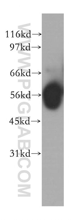 PPP2R5A Rabbit anti-Human, Mouse, Rat, Polyclonal, Proteintech:Antibodies:Primary
