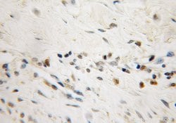 MUM1 Rabbit anti-Human, Polyclonal, Proteintech:Antibodies:Primary Antibodies