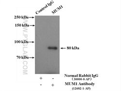 MUM1 Rabbit anti-Human, Polyclonal, Proteintech:Antibodies:Primary Antibodies