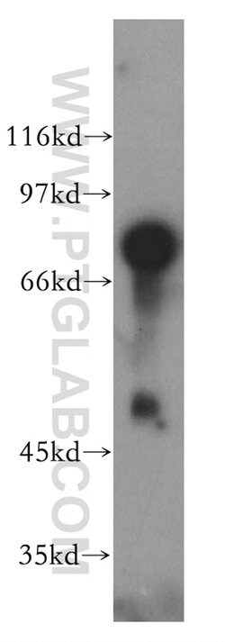 BHLHE41 Rabbit anti-Human, Mouse, Rat, Polyclonal, Proteintech 20 &mu;L | Buy Online | Proteintech | Fisher Scientific