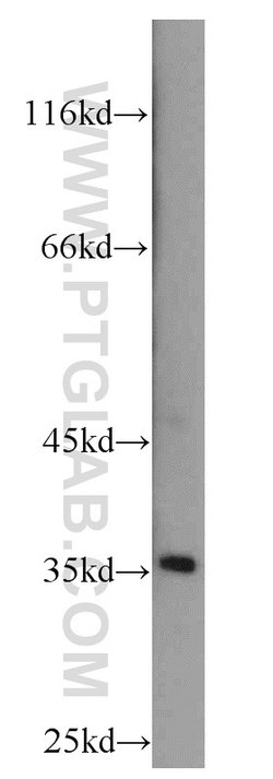 DPPA2 Rabbit anti-Human, Polyclonal, Proteintech:Antibodies:Primary Antibodies