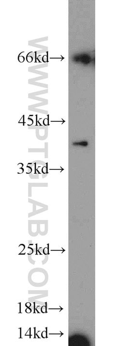 Kallikrein 11 Rabbit anti-Human, Mouse, Rat, Polyclonal, Proteintech:Antibodies:Primary