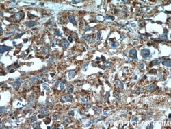SGK3 Rabbit anti-Human, Mouse, Rat, Polyclonal, Proteintech:Antibodies:Primary