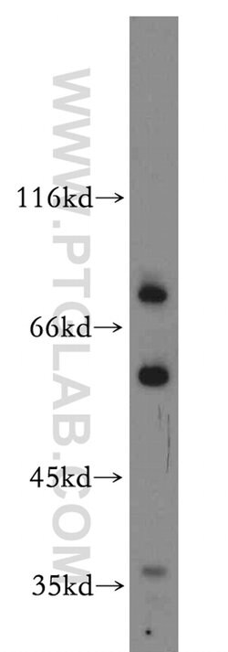 SHKBP1 Rabbit anti-Human, Mouse, Rat, Polyclonal, Proteintech 150 &mu;L | Buy Online | Proteintech Group Inc | Fisher Scientific