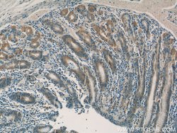 SNAP29 Rabbit anti-Human, Mouse, Rat, Polyclonal, Proteintech:Antibodies:Primary